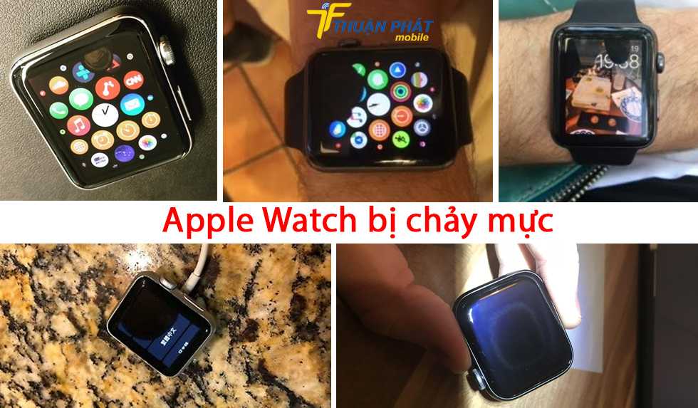 Apple Watch bị chảy mực