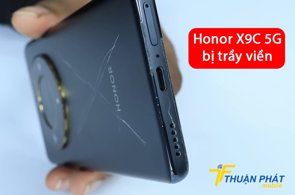 Honor X9C 5G bị trầy viền