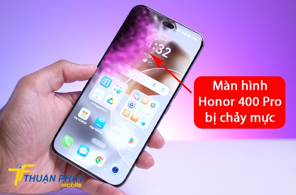 Màn hình Honor 400 Pro bị chảy mực