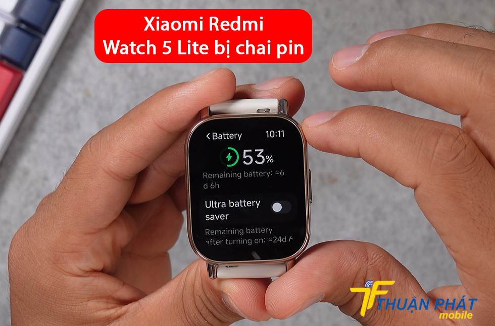 Xiaomi Redmi Watch 5 Lite bị chai pin